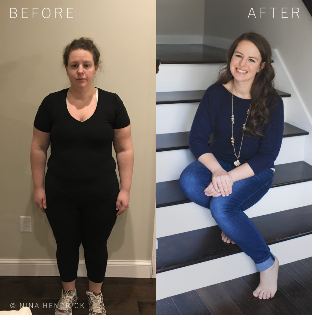 Weight Loss Success Stories After Hysterectomy: Inspiring Transformations